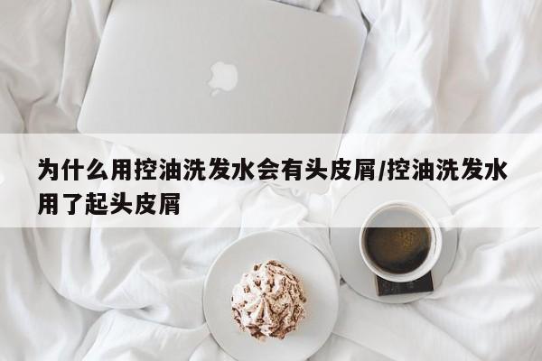 为什么用控油洗发水会有头皮屑/控油洗发水用了起头皮屑
