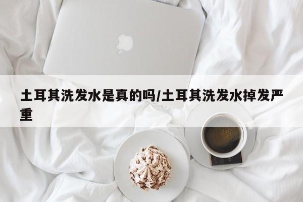 土耳其洗发水是真的吗/土耳其洗发水掉发严重